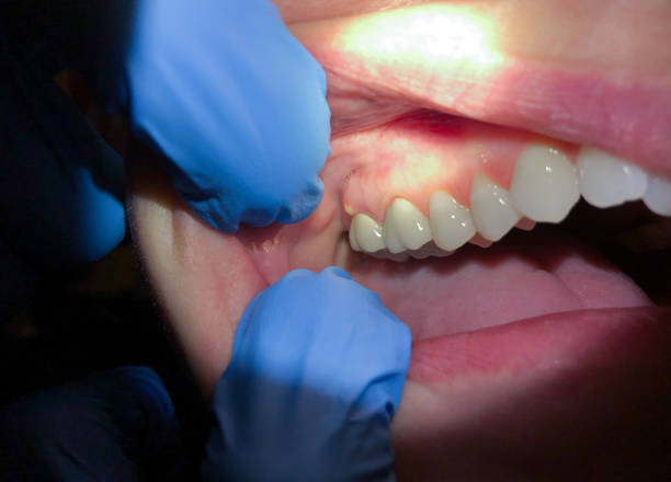Best Same-Day Emergency Dentist in Tishomingo, OK