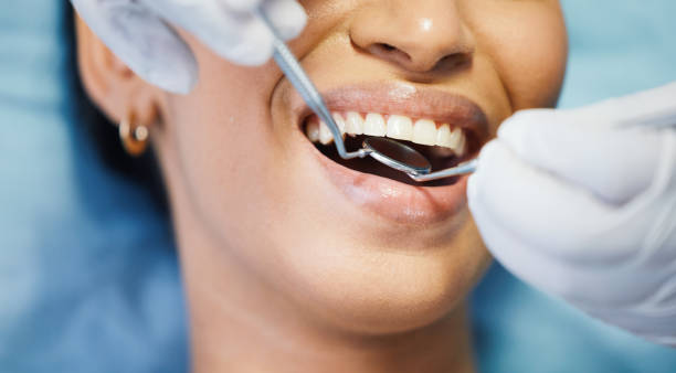 Best Emergency Tooth Extraction in Tishomingo, OK
