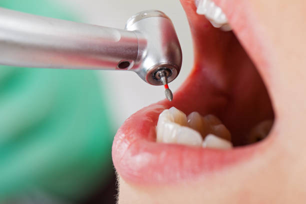 Best Emergency Dental Care for Trauma or Injury in Tishomingo, OK